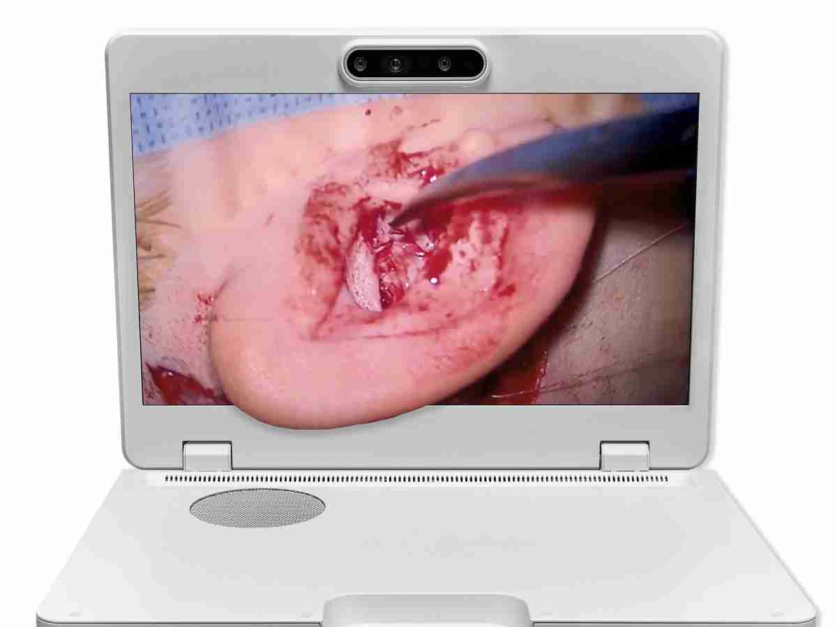 达擎之＂Heads-up 3D显微手术显示系统＂，，，整合4K裸眼3D显示及眼球追踪系统，，具备快速追踪人眼移动位置功能，，，减轻医师长时间维持固定姿势的负担，，，，让医师能有更宽广清晰的3D立体视野及更舒适的姿势来执行手术。。。。